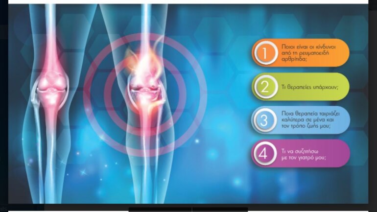 Παρουσίαση βοηθήματος λήψης απόφασης για τις θεραπείες της ρευματοειδούς αρθρίτιδας